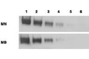 Western Blotting (WB) image for anti-Mesothelin (MSLN) (Extracellular Domain) antibody (ABIN400817) (Mesothelin antibody  (Extracellular Domain))