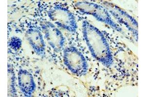 Immunohistochemistry of paraffin-embedded human duodenum tissue using ABIN7161653 at dilution of 1:100 (ULBP2 antibody  (AA 26-216))