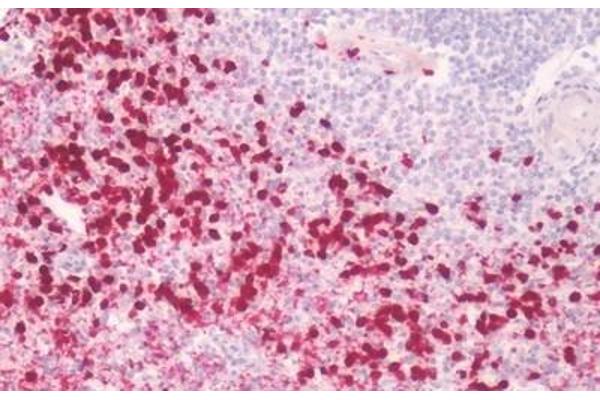 Prostaglandin E Synthase antibody  (Cytoplasmic Domain)