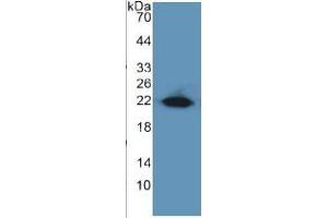 Western Blotting (WB) image for Early Growth Response 1 (EGR1) ELISA Kit (ABIN6730895)