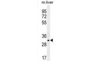 Western Blotting (WB) image for anti-JAZF Zinc Finger 1 (JAZF1) antibody (ABIN2996323) (JAZF1 antibody)