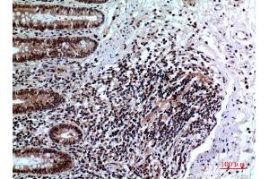 Immunohistochemical analysis of paraffin-embedded human-colon, antibody was diluted at 1:100. (FOXP3 antibody  (C-Term))