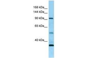 Image no. 1 for anti-Receptor Tyrosine Kinase-Like Orphan Receptor 1 (ROR1) (AA 155-204) antibody (ABIN6748473) (ROR1 antibody  (AA 155-204))