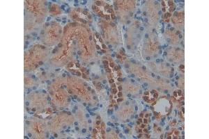 Used in DAB staining on fromalin fixed paraffin- embedded kidney tissue (PTPN14 antibody  (AA 1-188))