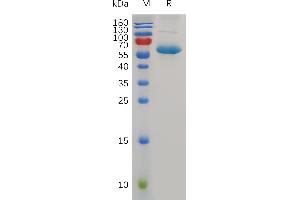 CD72 Protein (Fc Tag)