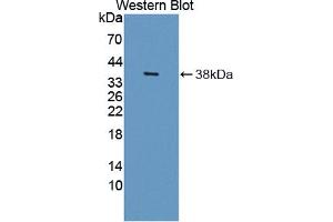 Western blot analysis of the recombinant protein. (HSD17B12 antibody  (AA 1-312))