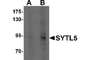 Western blot analysis of SYTL5 in Hela cell lysate with SYTL5 antibody at (A) 1 and (B) 2 µg/mL . (SYTL5 antibody  (N-Term))