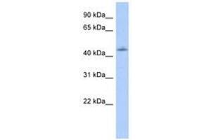 Image no. 1 for anti-Orthodenticle Homeobox 1 (OTX1) (AA 35-84) antibody (ABIN6740575) (OTX1 antibody  (AA 35-84))