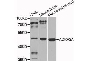 Western blot analysis of extracts of various cell lines, using ADRA2A antibody (ABIN5974628) at 1/1000 dilution. (ADRA2A antibody)