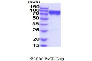 SDS-PAGE (SDS) image for Fibroblast Growth Factor Receptor 2 (FGFR2) (AA 22-378) protein (hIgG-His-tag) (ABIN5854934) (FGFR2 Protein (AA 22-378) (hIgG-His-tag))