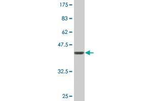 Western Blot detection against Immunogen (36. (TPX2 antibody  (AA 648-747))