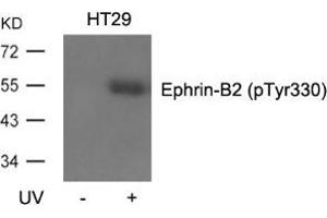 Western blot analysis of extracts from HT29 cells, untreated or treated with UV using Ephrin-B2 (Phospho-Tyr330). (Ephrin B2 antibody  (pTyr330))