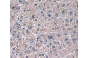 Used in DAB staining on fromalin fixed paraffin- embedded liver tissue (PTP4A2 antibody  (AA 1-167))