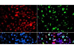Immunofluorescence analysis of GFP-RNF168 transgenic U2OS cells using POLD3 Polyclonal Antibody (POLD3 antibody)