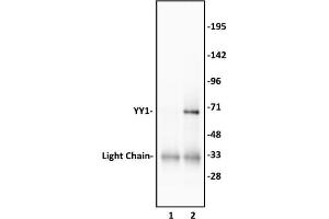 YY1 antibody (pAb) tested by Western blot. (YY1 antibody)