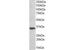 ABIN184598 (0. (TMX1 antibody  (C-Term))
