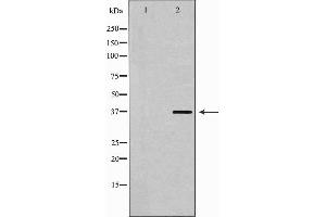 Western blot analysis of extracts of Jurkat , using CDK6antibody. (CDK6 antibody  (N-Term))