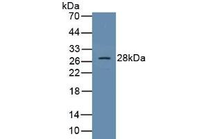Detection of Recombinant SOCS1, Human using Polyclonal Antibody to Suppressors Of Cytokine Signaling 1 (SOCS1) (Suppressors Of Cytokine Signaling 1 (AA 1-211) antibody)
