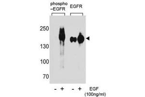 Western blot analysis of extracts from A431 cells, untreated or treated with EGF using phospho-EGFR antibody (left) or nonphos Ab (right). (EGFR antibody  (pTyr1172))