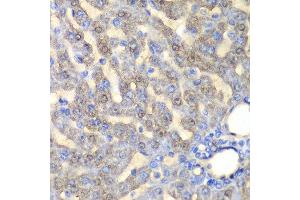 Immunohistochemistry of paraffin-embedded rat liver using FAH antibody at dilution of 1:100 (x40 lens). (FAH antibody)