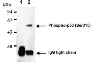 Western Blotting (WB) image for anti-Tumor Protein P53 (TP53) (pSer315) antibody (ABIN487474) (p53 antibody  (pSer315))