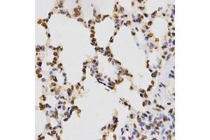 Immunohistochemistry (IHC) image for anti-Histone 3 (H3) (H3K9me) antibody (ABIN1872999) (Histone 3 antibody  (H3K9me))