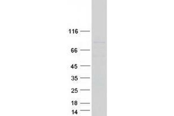 Transglutaminase 5 Protein (TGM5) (Transcript Variant 1) (Myc-DYKDDDDK Tag)