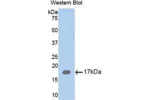 Western blot analysis of the recombinant protein. (Chemerin antibody  (AA 33-158))