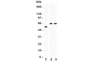 Western blot testing of CYP2E1 antibody and Lane 1:  rat liver;  2: human HeLa;  3: (h) Jurkat;  Observed size: 56-65KD (CYP2E1 antibody  (AA 1-310))