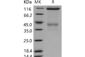 Western Blotting (WB) image for Met Proto-Oncogene (MET) (Active) protein (Fc Tag) (ABIN7196991) (c-MET Protein (Fc Tag))