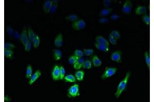 Immunofluorescent analysis of HepG2 cells using ABIN7171883 at dilution of 1:100 and Alexa Fluor 488-congugated AffiniPure Goat Anti-Rabbit IgG(H+L) (Tetraspanin 6 antibody  (AA 115-208))