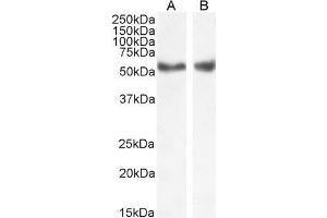 ABIN185294 (1µg/ml) staining of Human Liver (A) and Kidney (B) lysate (35µg protein in RIPA buffer). (Nuclear Receptor Subfamily 1, Group H, Member 2/3 (NR1H2/3) (AA 429-442), (AA 443-456) antibody)