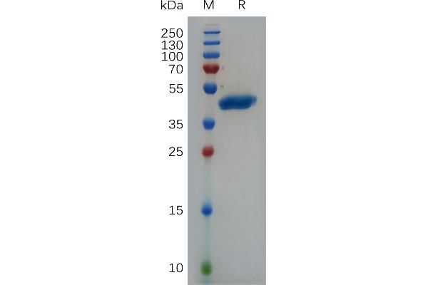 VEGFA Protein (AA 27-147) (Fc Tag)