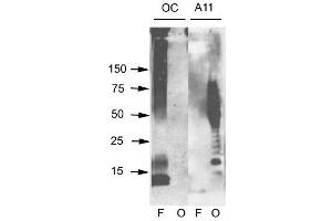 Western Blotting (WB) image for anti-Amyloid beta (A4) Precursor Protein (APP) antibody (ABIN6655141)