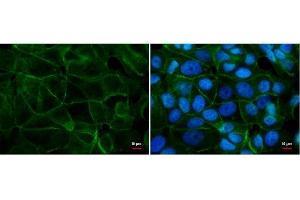 Immunofluorescence (IF) image for anti-Cadherin 1, Type 1, E-Cadherin (Epithelial) (CDH1) antibody (ABIN2854751)