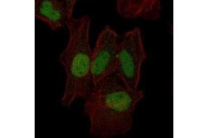 Immunofluorescence (IF) image for anti-Mitogen-Activated Protein Kinase Kinase 7 (MAP2K7) antibody (ABIN969271)