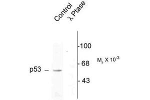 Image no. 2 for anti-Tumor Protein P53 (TP53) (pSer392) antibody (ABIN228202) (p53 antibody  (pSer392))