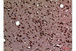 Immunohistochemical analysis of paraffin-embedded rat-brain, antibody was diluted at 1:100. (Pleiotrophin antibody  (Internal Region))