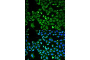 Immunofluorescence analysis of A549 cell using ECI1 antibody. (DCI antibody)