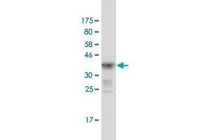 Western Blot detection against Immunogen (36. (MUTYH antibody  (AA 436-535))