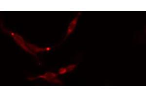 ABIN6273768 staining NIH-3T3 cells by IF/ICC. (MAP2K7 antibody  (Internal Region))