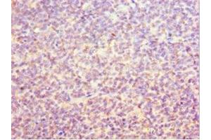 Immunohistochemistry of paraffin-embedded human tonsil tissue using ABIN7162275 at dilution of 1:100 (ORC6 antibody  (AA 1-252))