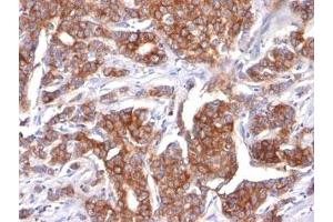 Image no. 2 for anti-Keratin 18 (KRT18) antibody (ABIN3026949) (Cytokeratin 18 antibody)