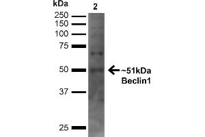 Western blot analysis of Human Embryonic kidney epithelial cell line (HEK293T) lysate showing detection of ~51 kDa Beclin 1 protein using Rabbit Anti-Beclin 1 Polyclonal Antibody (ABIN2868759). (Beclin 1 antibody  (C-Term) (Atto 488))