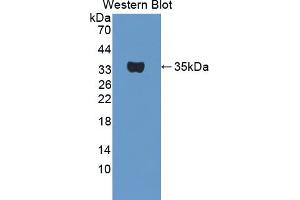 Figure. (TPSB2 antibody  (AA 30-276))