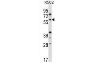 Western Blotting (WB) image for anti-Recombination Activating Gene 2 (RAG2) antibody (ABIN5978584) (RAG2 antibody)