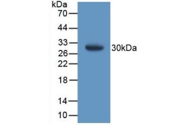 GSTT1 antibody  (AA 7-240)