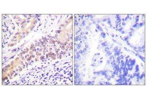 Immunohistochemistry (IHC) image for anti-Topoisomerase (DNA) II beta 180kDa (TOP2B) (N-Term) antibody (ABIN1848858) (TOP2B antibody  (N-Term))