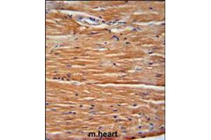 GIT1 Antibody immunohistochemistry analysis in formalin fixed and paraffin embedded mouse heart tissue followed by peroxidase conjugation of the secondary antibody and DAB staining. (GIT1 antibody  (AA 485-512))
