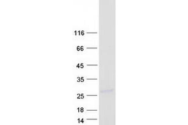 CST9L Protein (Myc-DYKDDDDK Tag)